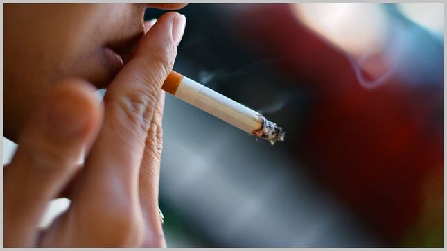 Smoking causes the development of varicose veins