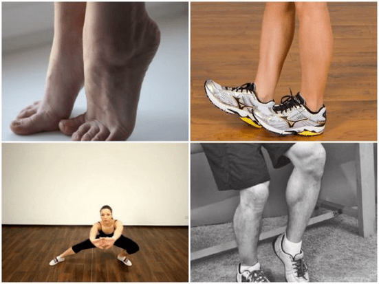 varicose veins cause leg pain