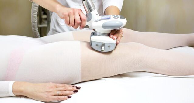 Apparatus massage for varicose veins