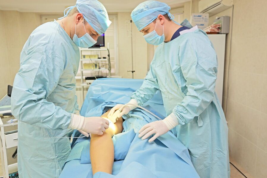 Surgery for varicose veins of small pelvic vessels