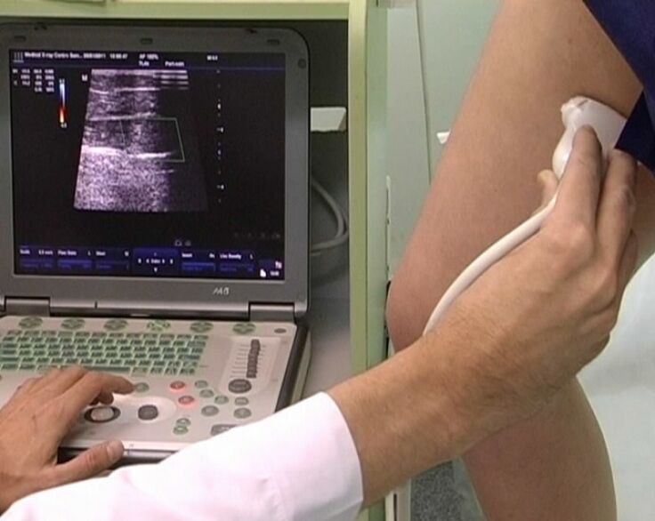 Ultrasound diagnosis of pelvic varicose veins