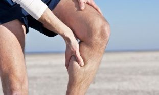 varicose veins in the legs of men